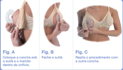 Como fazem a operação plástica em um peito